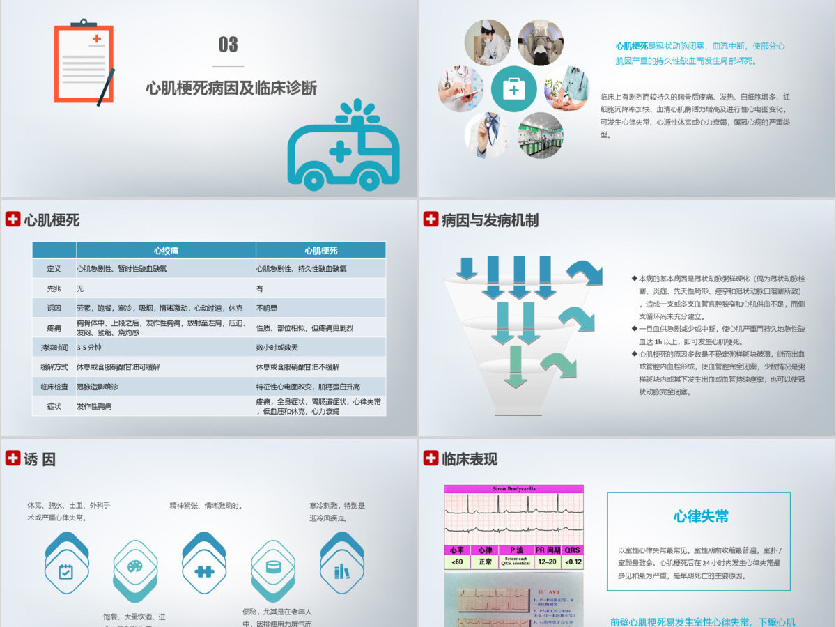 简约大气急性心梗护理查房PPT