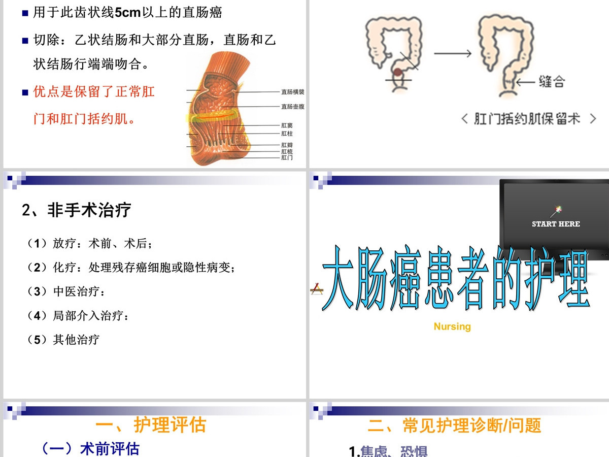结肠癌直肠癌患者的护理护理查房PPT 结肠癌直肠癌患者的护理护理查房PPT
