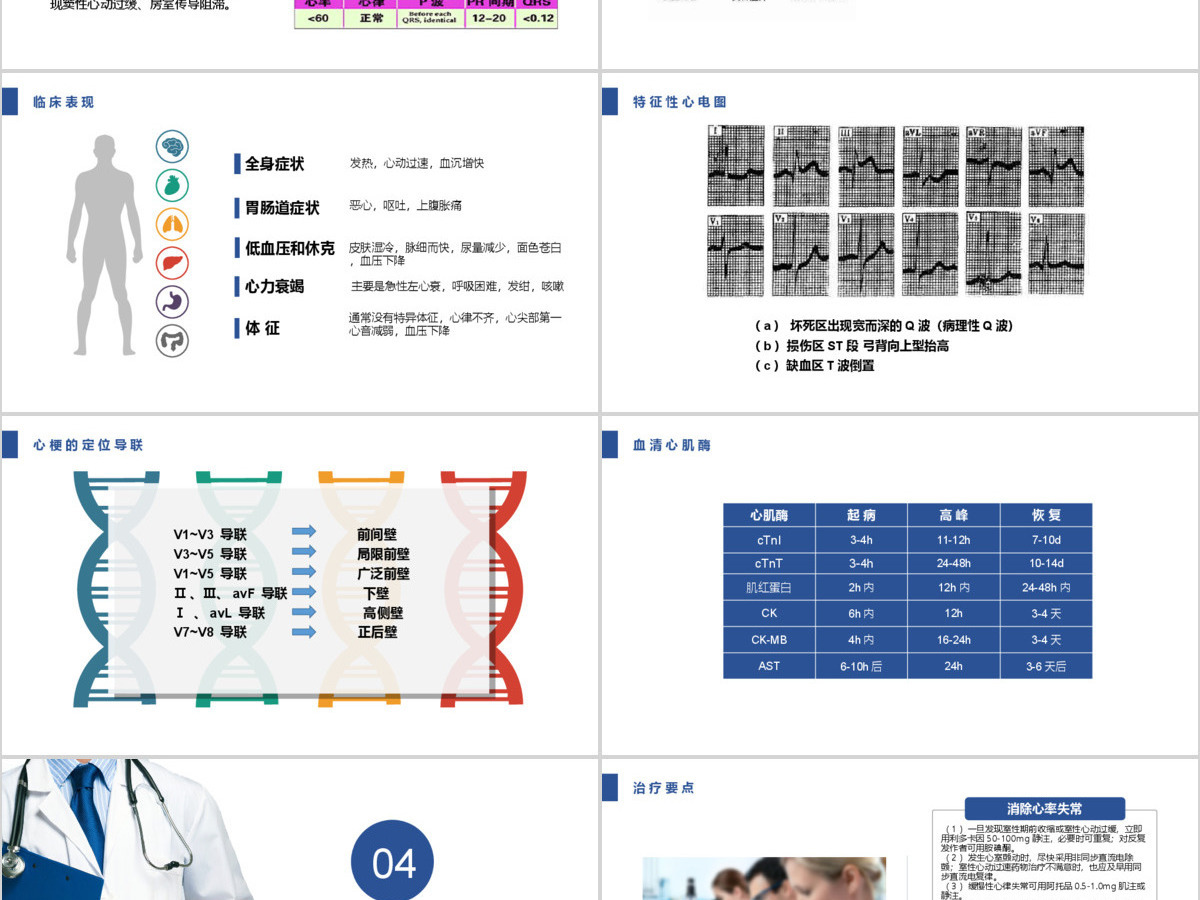 急性心肌梗死护理查房PPT