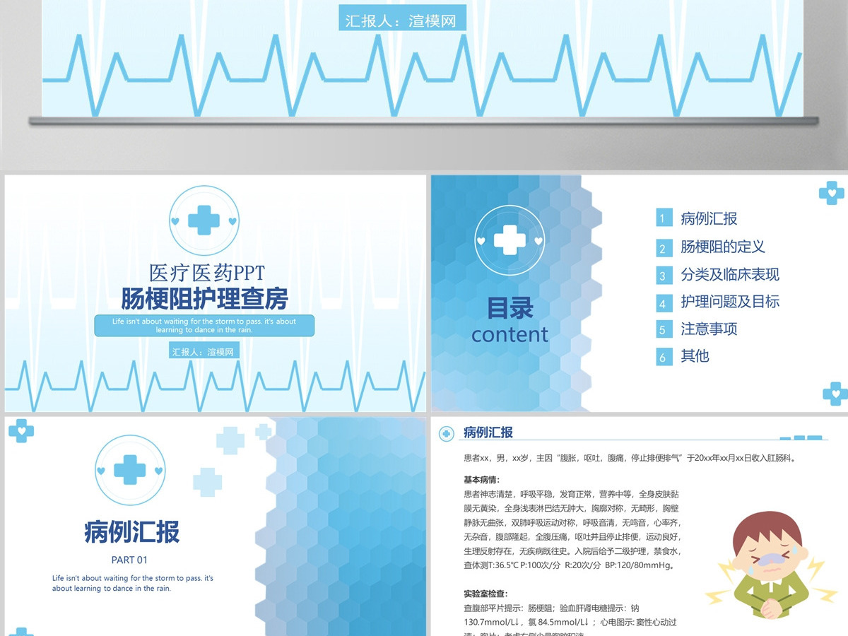 2022肠梗阻医疗护理查房清新简约护理查房通用PPT