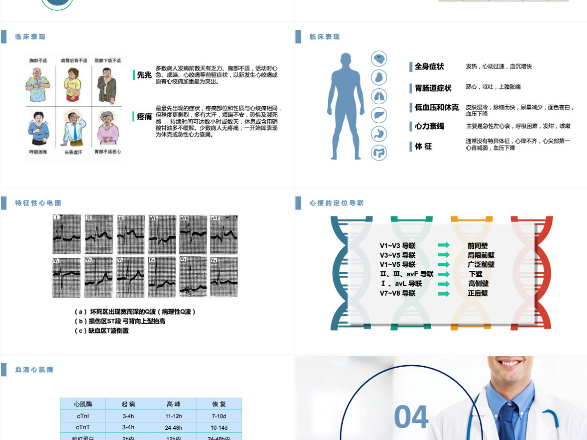 2022急性心肌梗死医疗护理查房淡蓝清新护理查房通用PPT 2022急性心肌梗死医疗护理查房淡蓝清新护理查房通用PPT