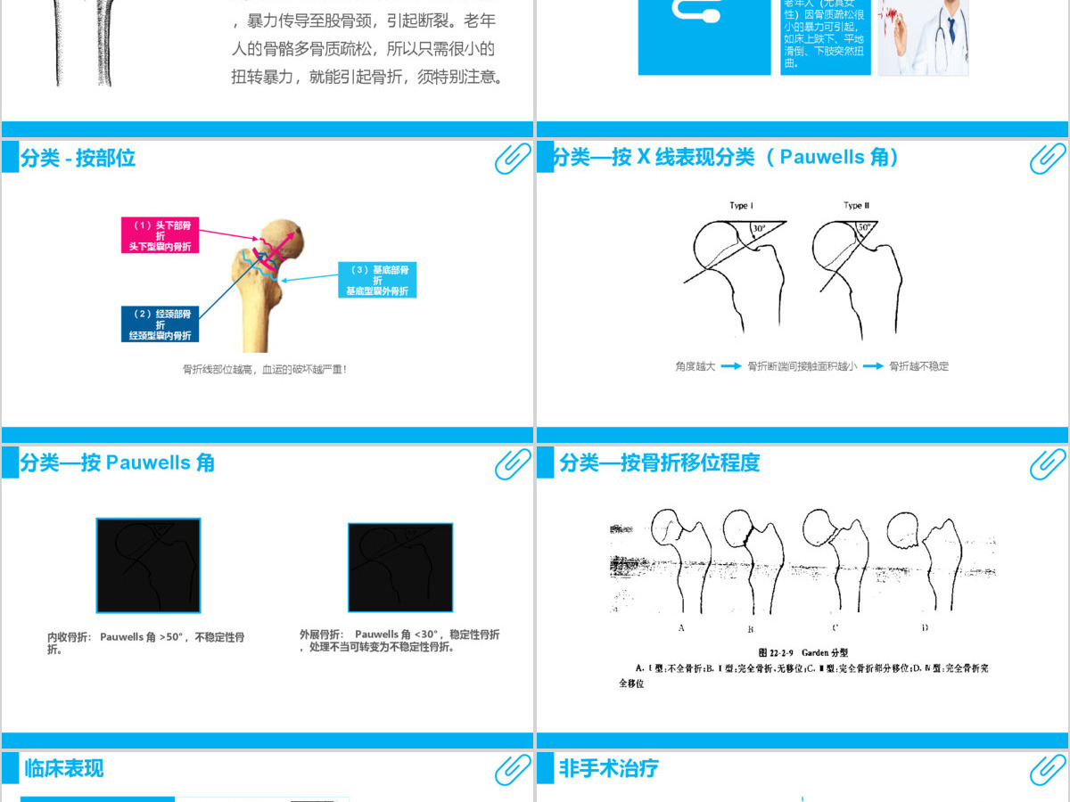 股骨颈骨折护理查房ppt