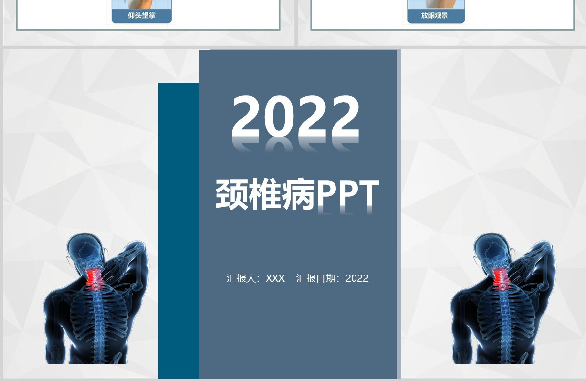 2022医药医疗颈椎病护理清新简约医疗类通用PPT模板