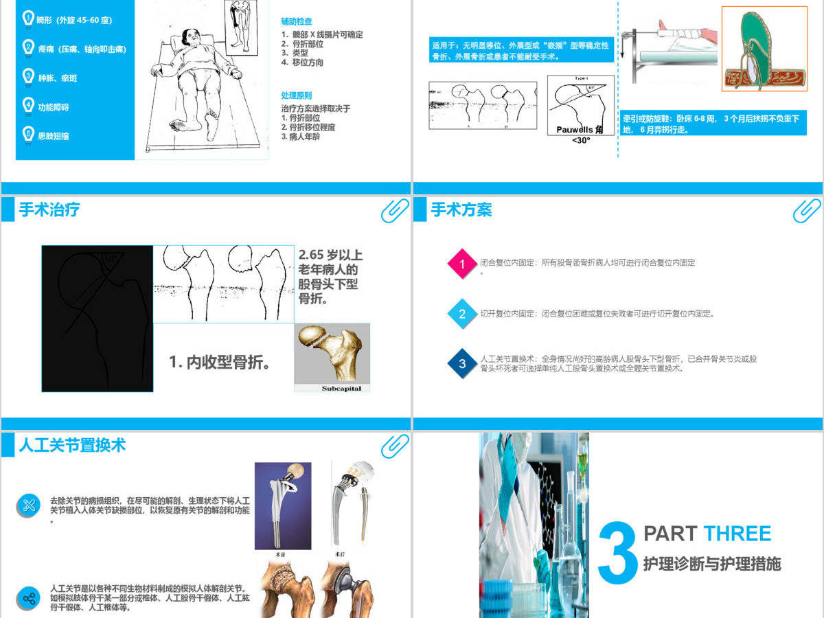 股骨颈骨折护理查房ppt