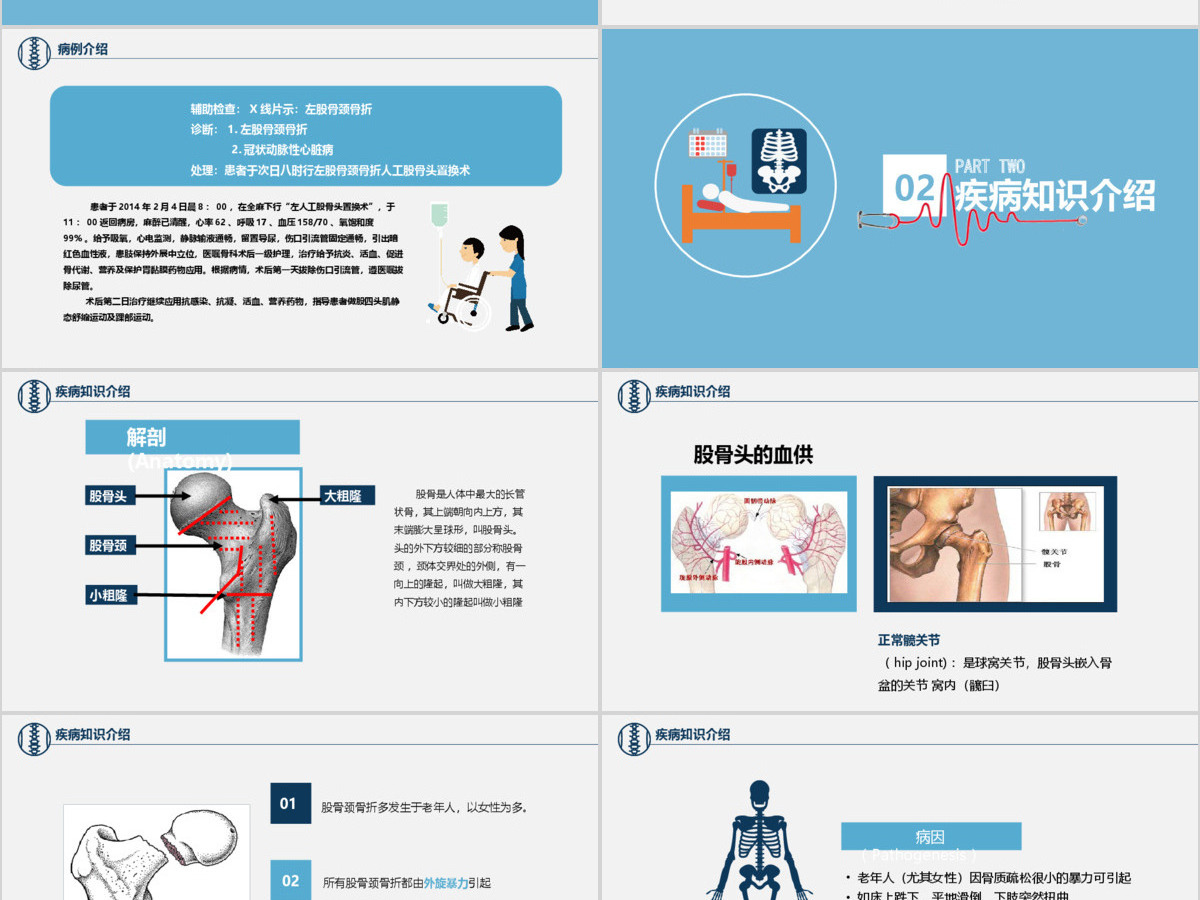股骨颈骨折护理查房ppt 股骨颈骨折护理查房ppt