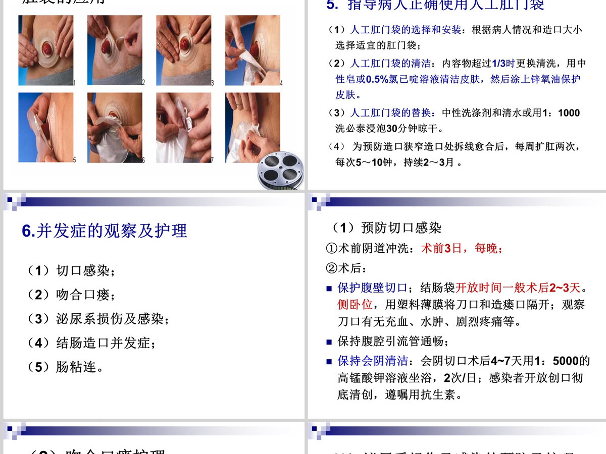 结肠癌直肠癌患者的护理护理查房PPT 结肠癌直肠癌患者的护理护理查房PPT