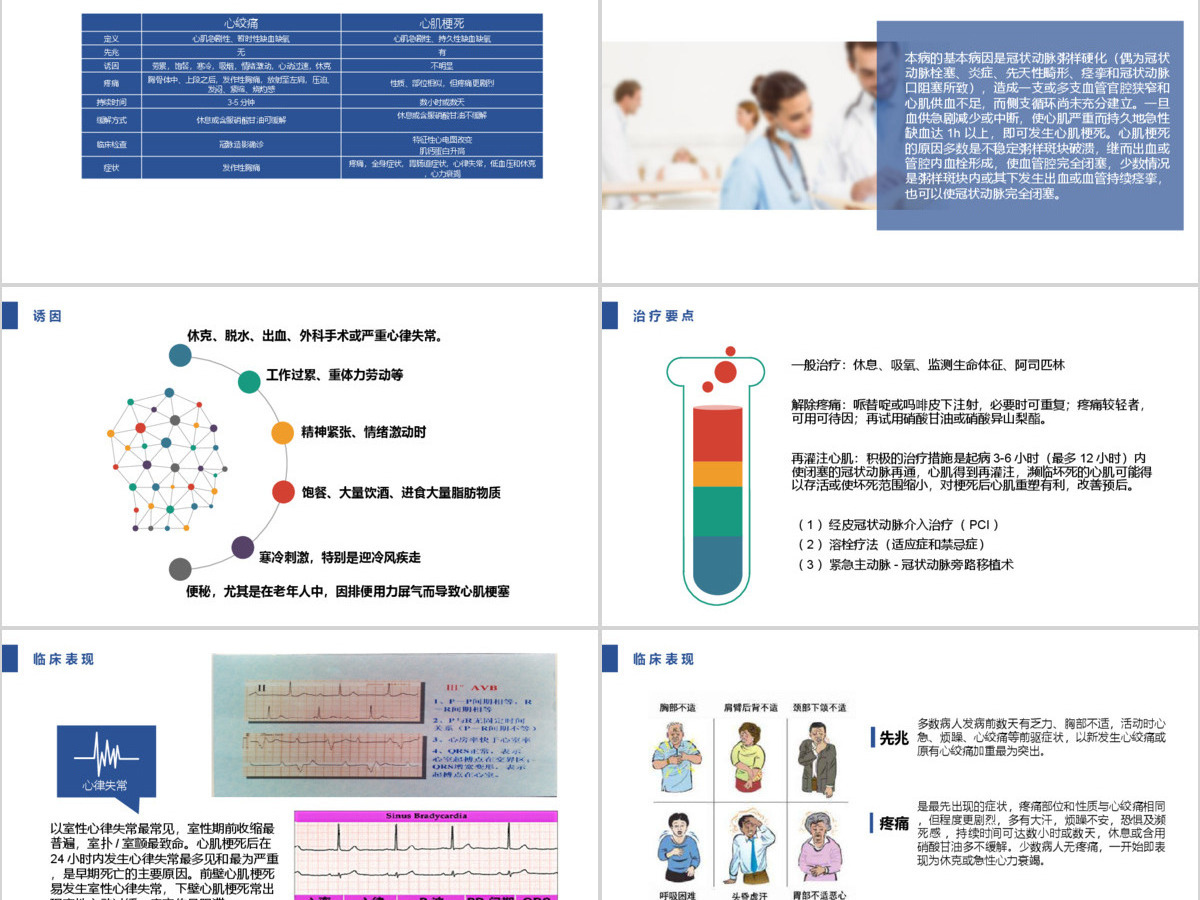 急性心肌梗死护理查房PPT