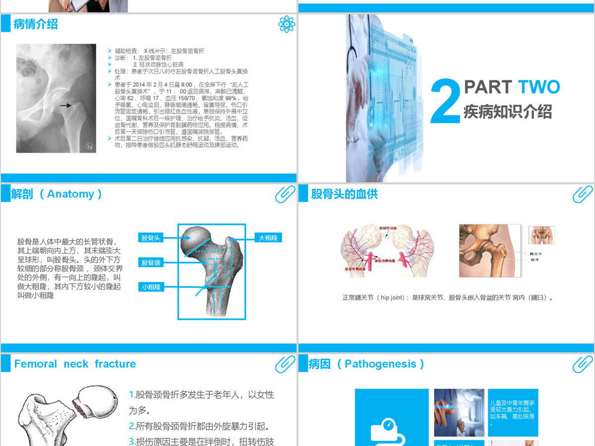 股骨颈骨折护理查房ppt
