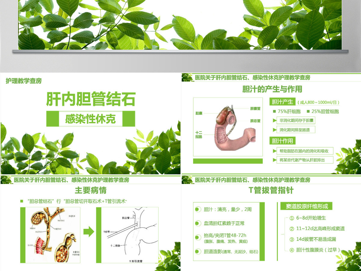感染性休克肝胆内结石护理教学查房PPT模版