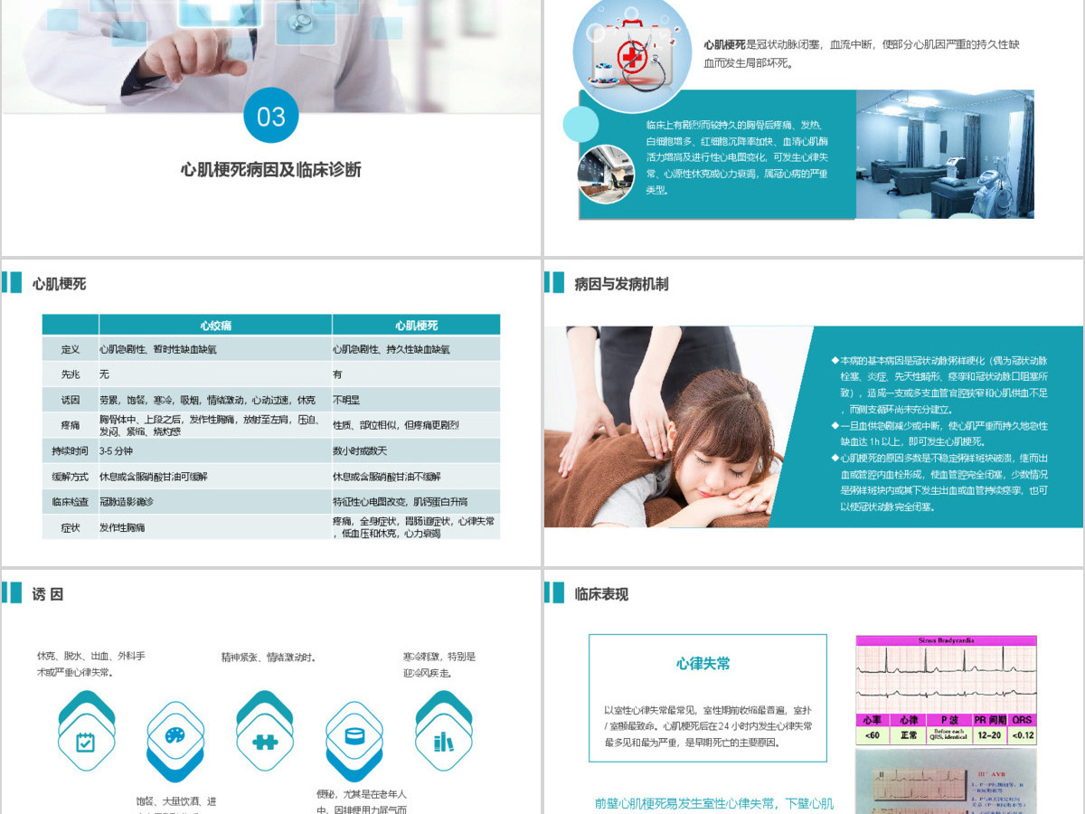 精美大气急性心梗护理查房PPT