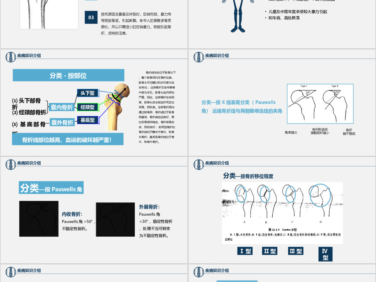 股骨颈骨折护理查房ppt 股骨颈骨折护理查房ppt