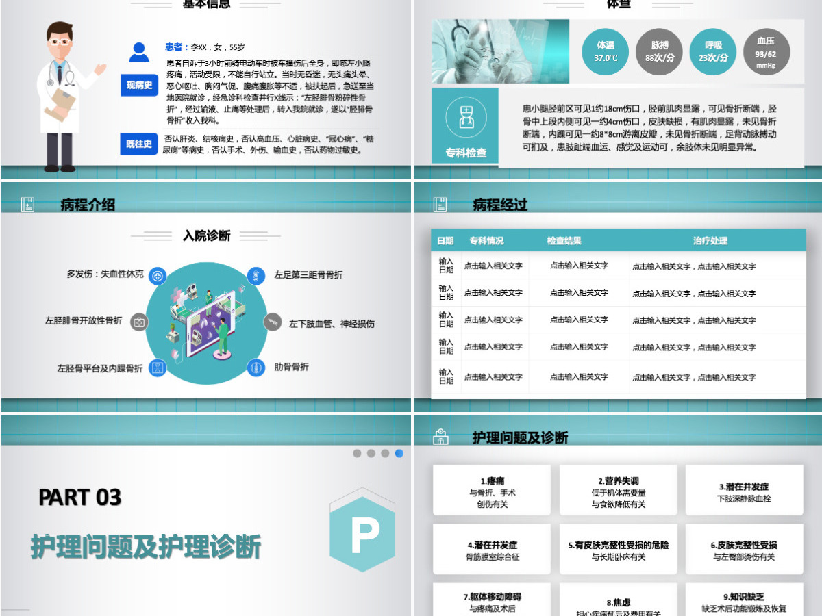 2022胫腓骨骨折护理简约个性医学护理通用PPT 2022胫腓骨骨折护理简约个性医学护理通用PPT