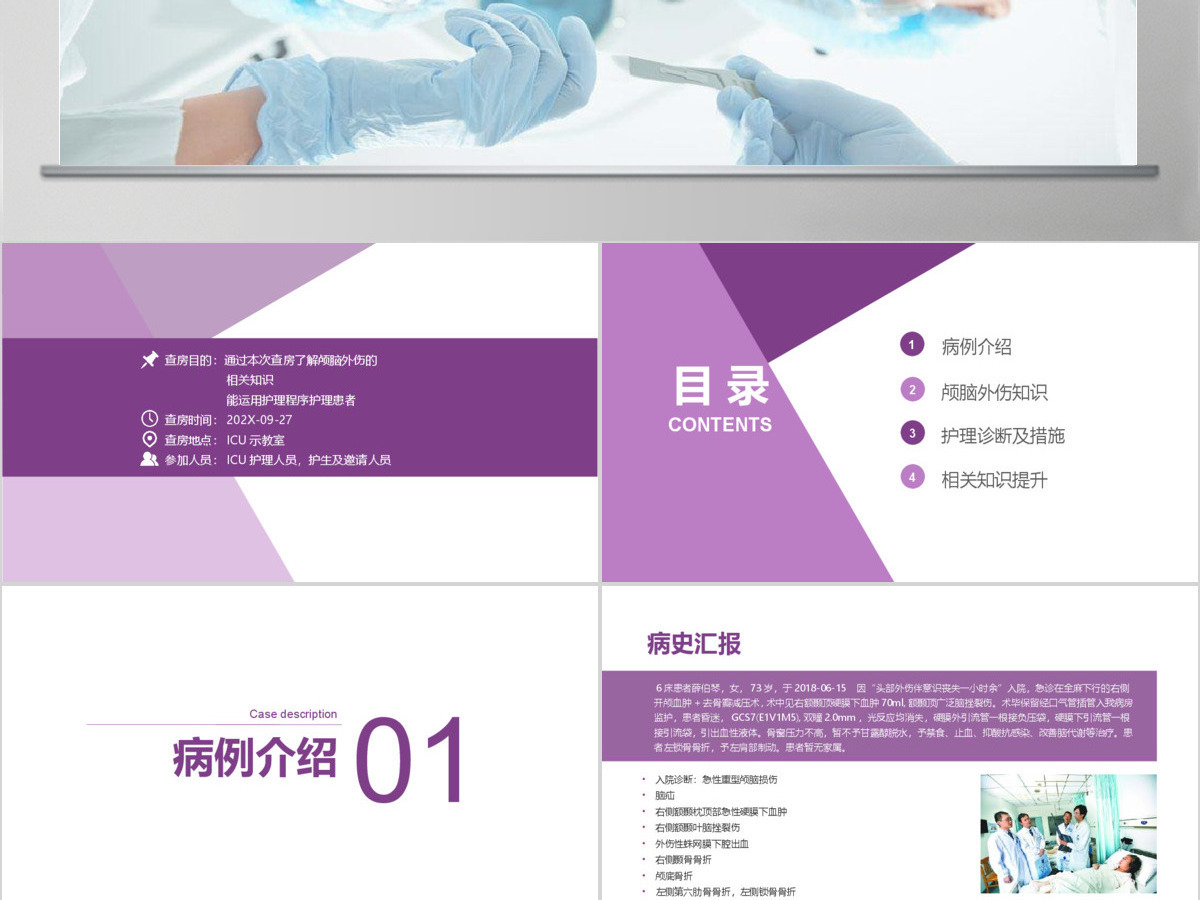 实用大气颅脑外伤护理查房PPT 实用大气颅脑外伤护理查房PPT