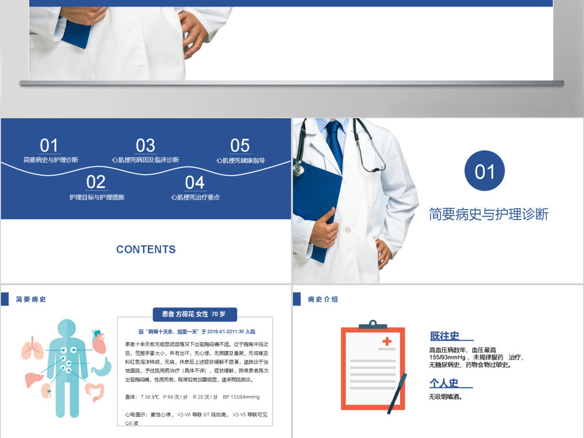 急性心肌梗死护理查房PPT