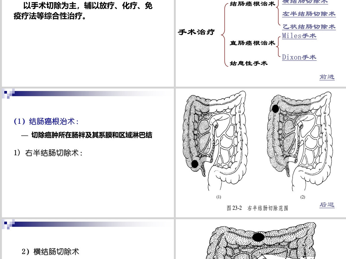 结肠癌直肠癌患者的护理护理查房PPT 结肠癌直肠癌患者的护理护理查房PPT