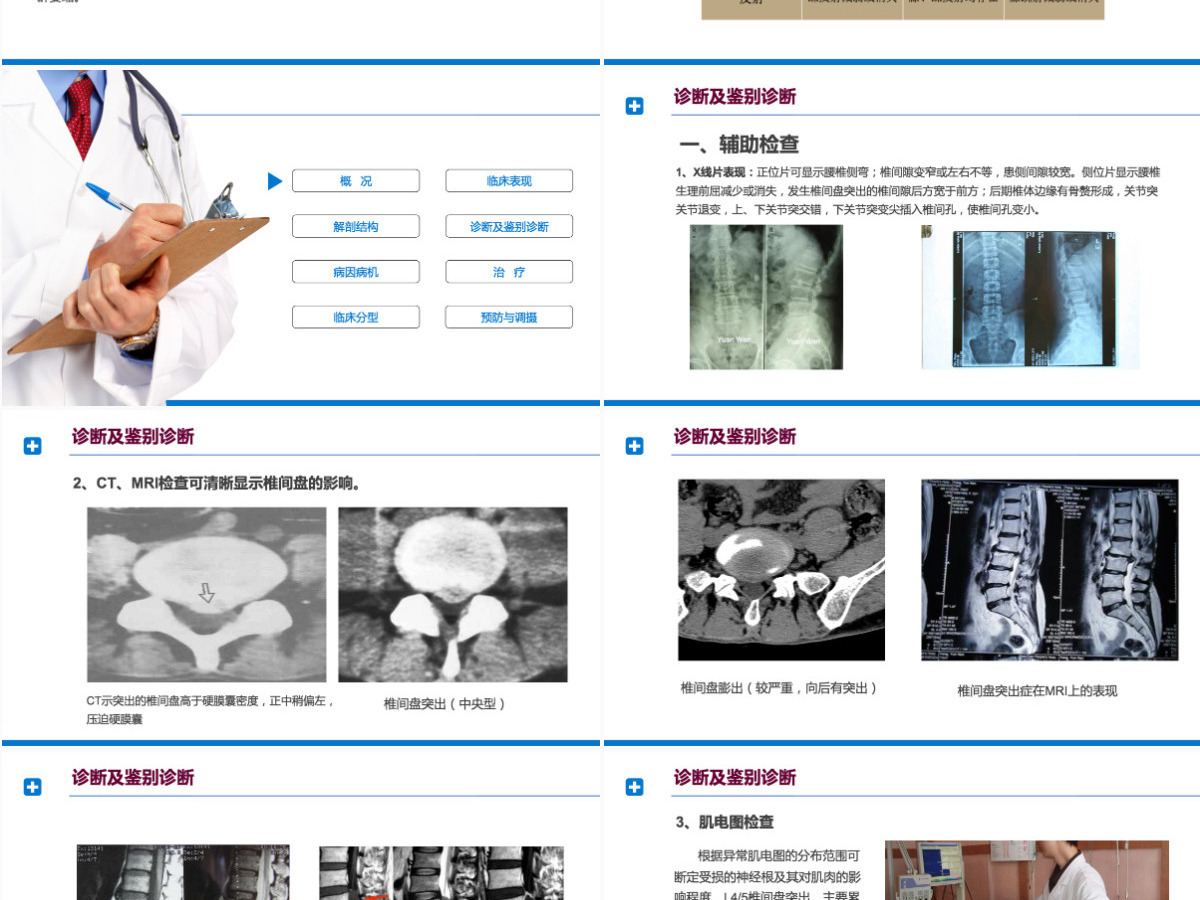 2022腰椎间盘突出症诊断与治疗清新商务医疗风医学通用PPT模板 2022腰椎间盘突出症诊断与治疗清新商务医疗风医学通用PPT模板