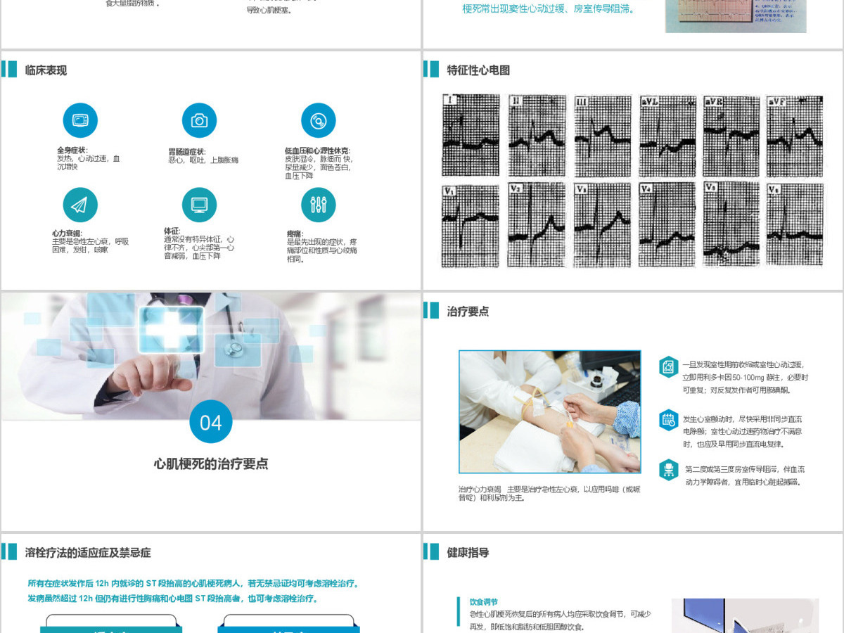 精美大气急性心梗护理查房PPT