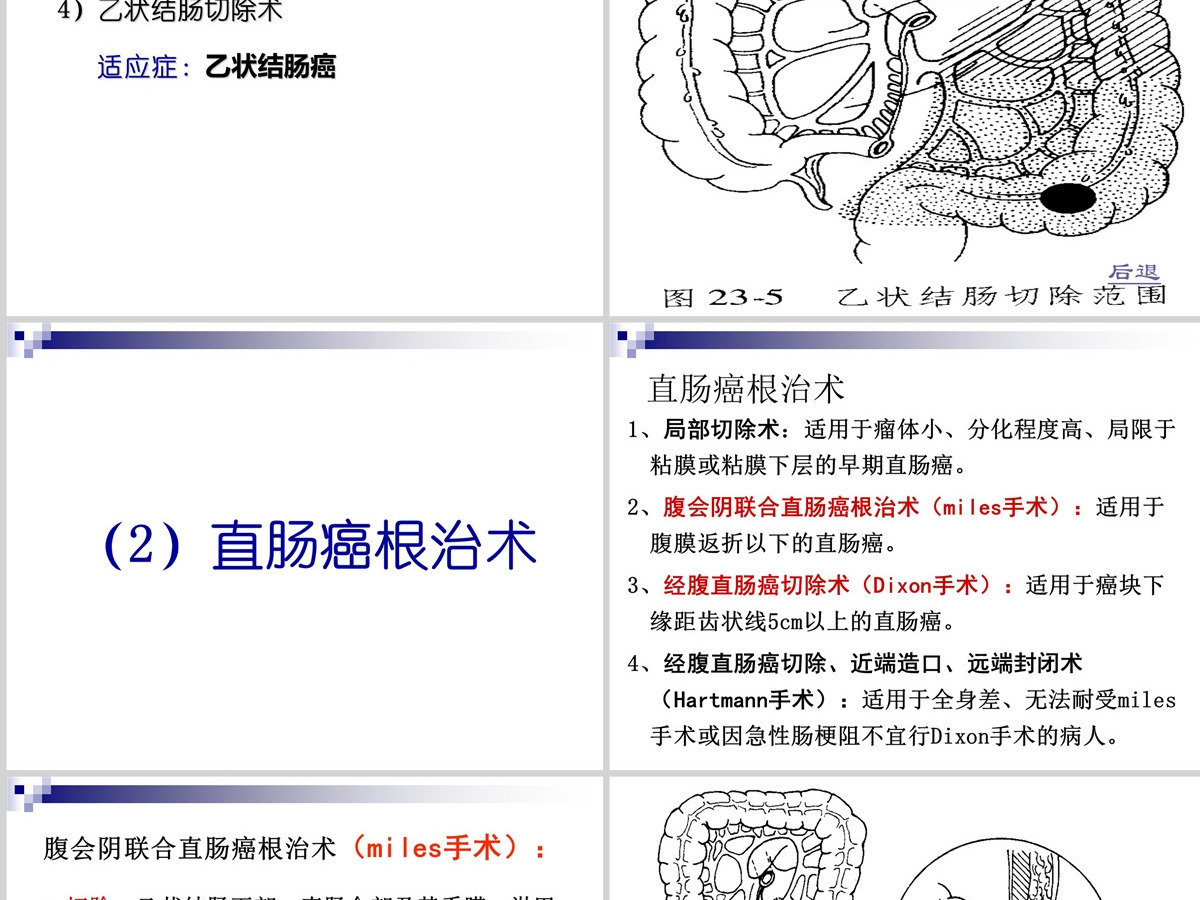 结肠癌直肠癌患者的护理护理查房PPT 结肠癌直肠癌患者的护理护理查房PPT