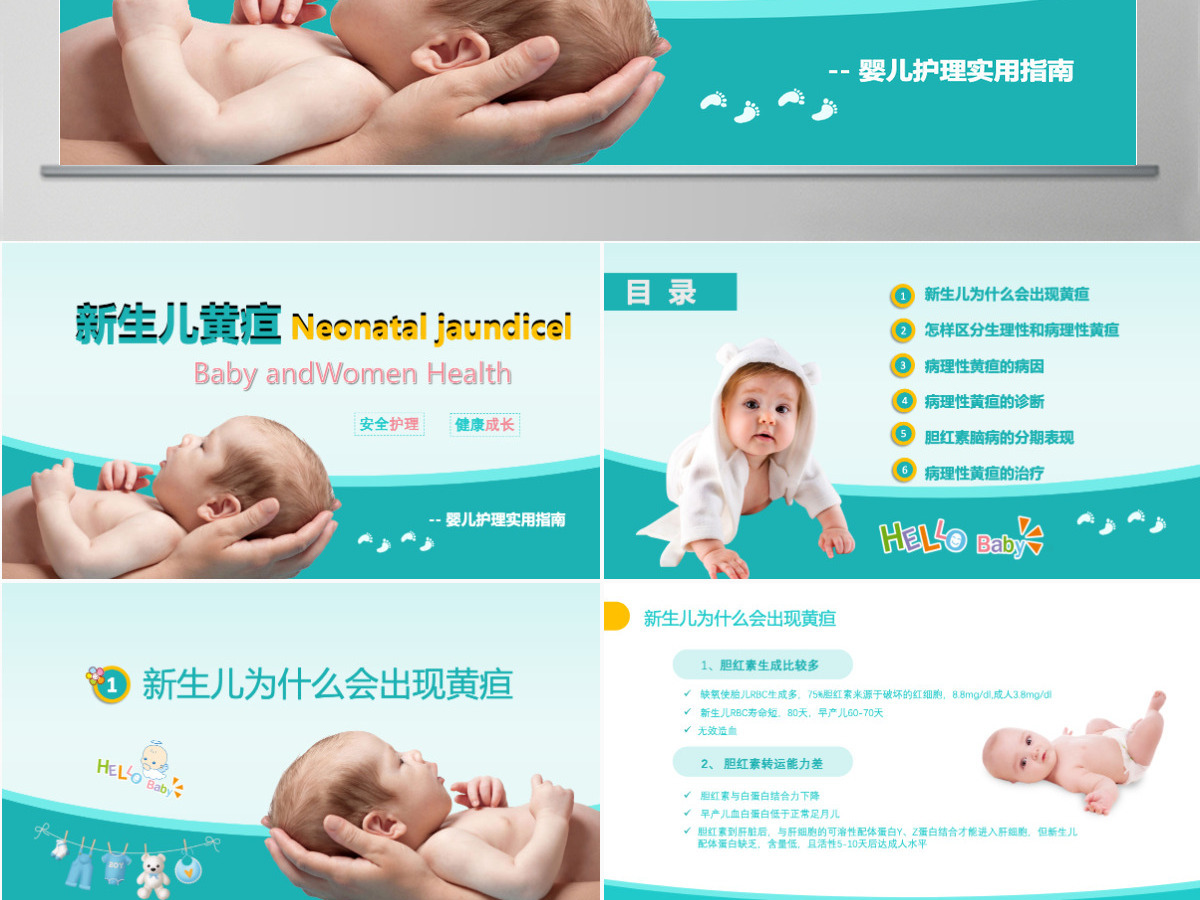 卡通医疗新生儿黄疸治疗护理知识PPT 卡通医疗新生儿黄疸治疗护理知识PPT
