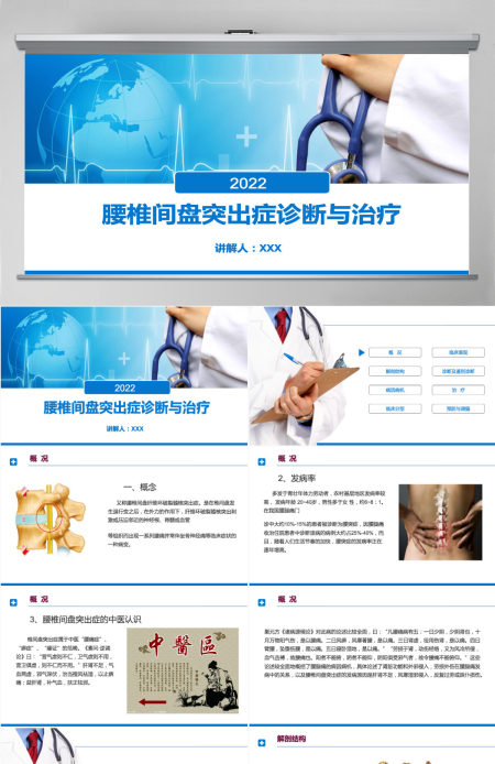 2022腰椎间盘突出症诊断与治疗清新商务医疗风医学通用PPT模板